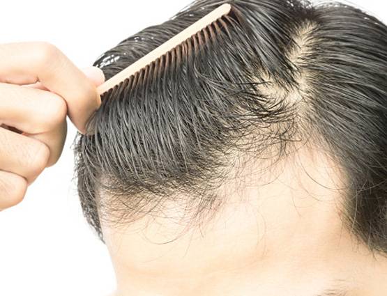 किसी दवा की जरूरत नहीं, बालों को झड़ने और सफेद होने से ऐसे रोकें