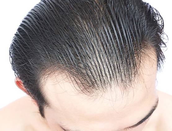 किसी दवा की जरूरत नहीं, बालों को झड़ने और सफेद होने से ऐसे रोकें