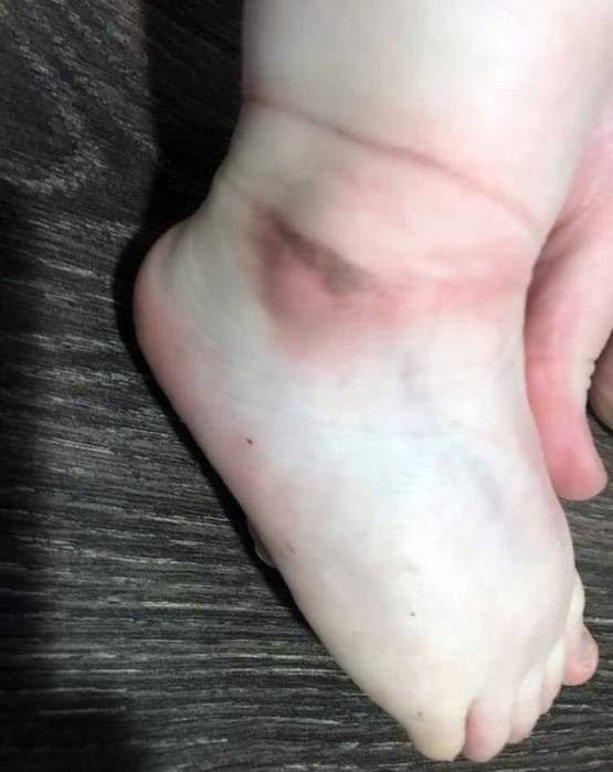 बच्ची को डे केयर में छोड़कर आई थी मां, हालत देख रह गई हैरान