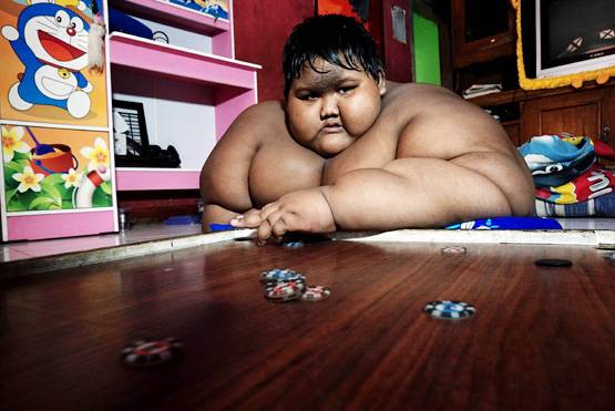 'दुनिया का सबसे मोटा लड़का': 10 की उम्र में था 190 किलो वजन