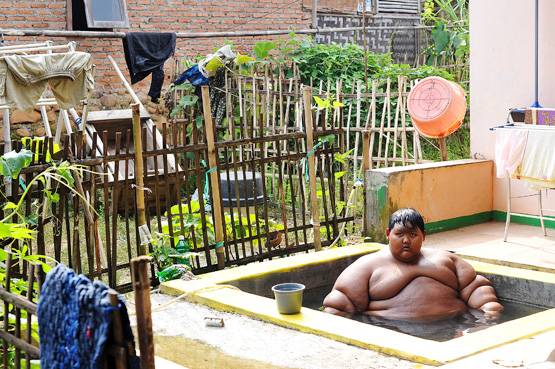 'दुनिया का सबसे मोटा लड़का': 10 की उम्र में था 190 किलो वजन