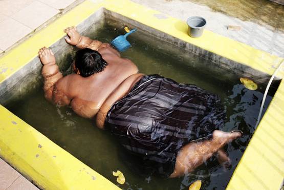 'दुनिया का सबसे मोटा लड़का': 10 की उम्र में था 190 किलो वजन