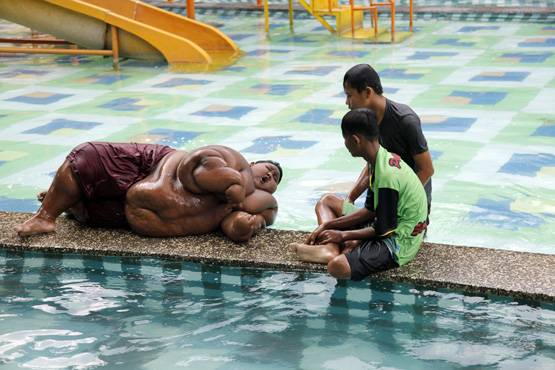 'दुनिया का सबसे मोटा लड़का': 10 की उम्र में था 190 किलो वजन