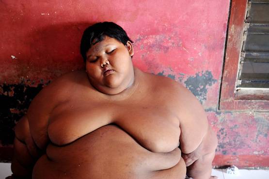 'दुनिया का सबसे मोटा लड़का': 10 की उम्र में था 190 किलो वजन