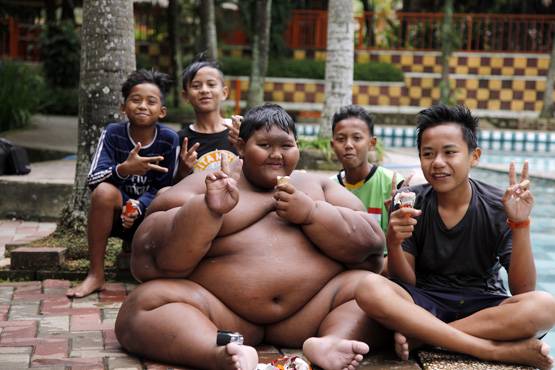 'दुनिया का सबसे मोटा लड़का': 10 की उम्र में था 190 किलो वजन