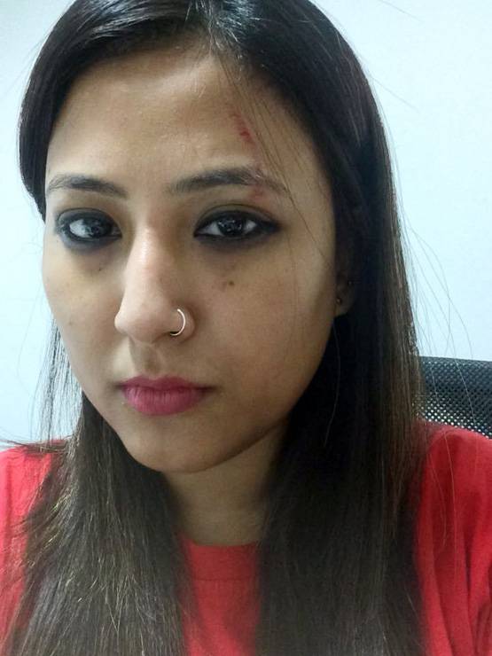 उबर कैब में 2 महिलाओं में मारपीट: पत्रकार के बाल खींचे, किया घायल