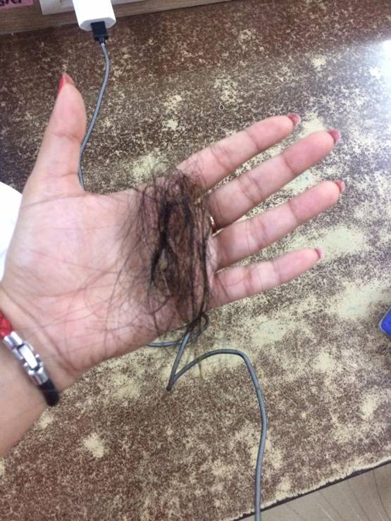 उबर कैब में 2 महिलाओं में मारपीट: पत्रकार के बाल खींचे, किया घायल