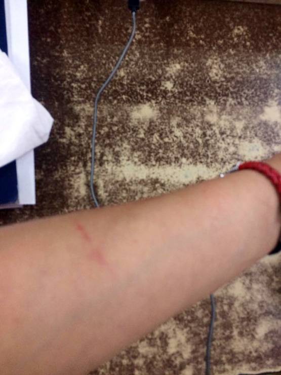 उबर कैब में 2 महिलाओं में मारपीट: पत्रकार के बाल खींचे, किया घायल