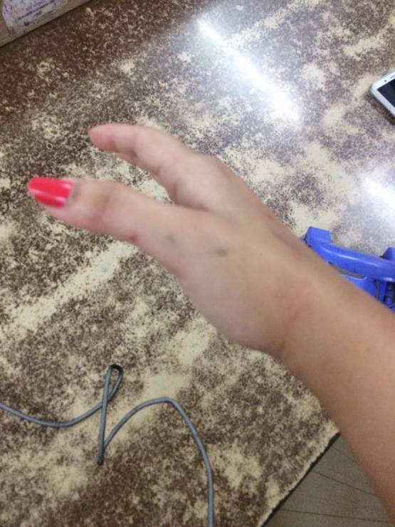 उबर कैब में 2 महिलाओं में मारपीट: पत्रकार के बाल खींचे, किया घायल