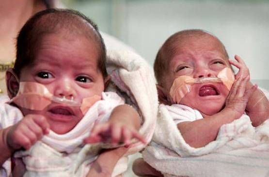 ये है भारत की सबसे छोटी बच्ची, वजन महज 375 ग्राम