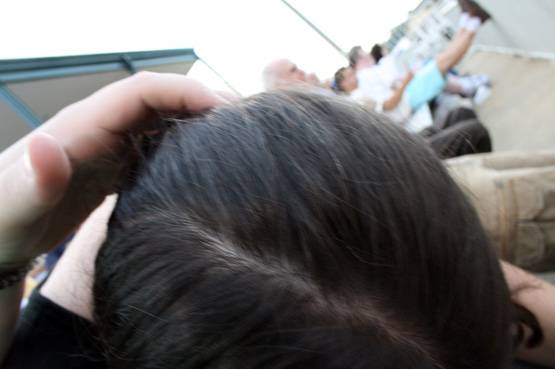 25 की उम्र से पहले बालों का सफेद होना बीमारी, करें ये उपाय