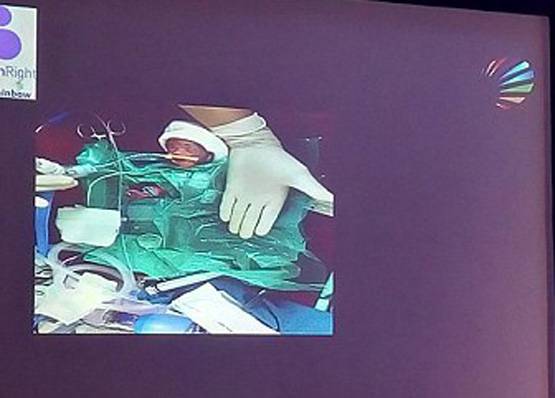 ये है भारत की सबसे छोटी बच्ची, वजन महज 375 ग्राम