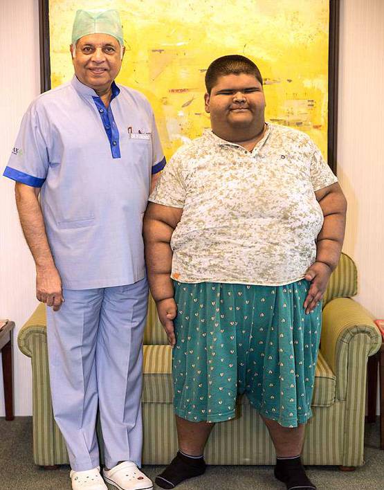 मिहिर दुनिया का सबसे मोटा बच्चा, 14 की उम्र में 237 Kg वजन!