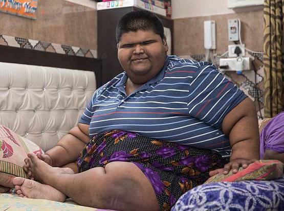 मिहिर दुनिया का सबसे मोटा बच्चा, 14 की उम्र में 237 Kg वजन!