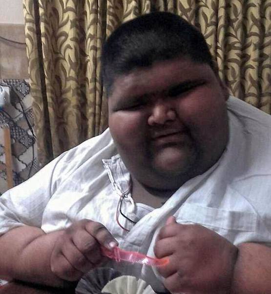 मिहिर दुनिया का सबसे मोटा बच्चा, 14 की उम्र में 237 Kg वजन!