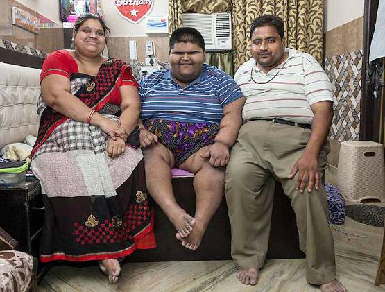 मिहिर दुनिया का सबसे मोटा बच्चा, 14 की उम्र में 237 Kg वजन!