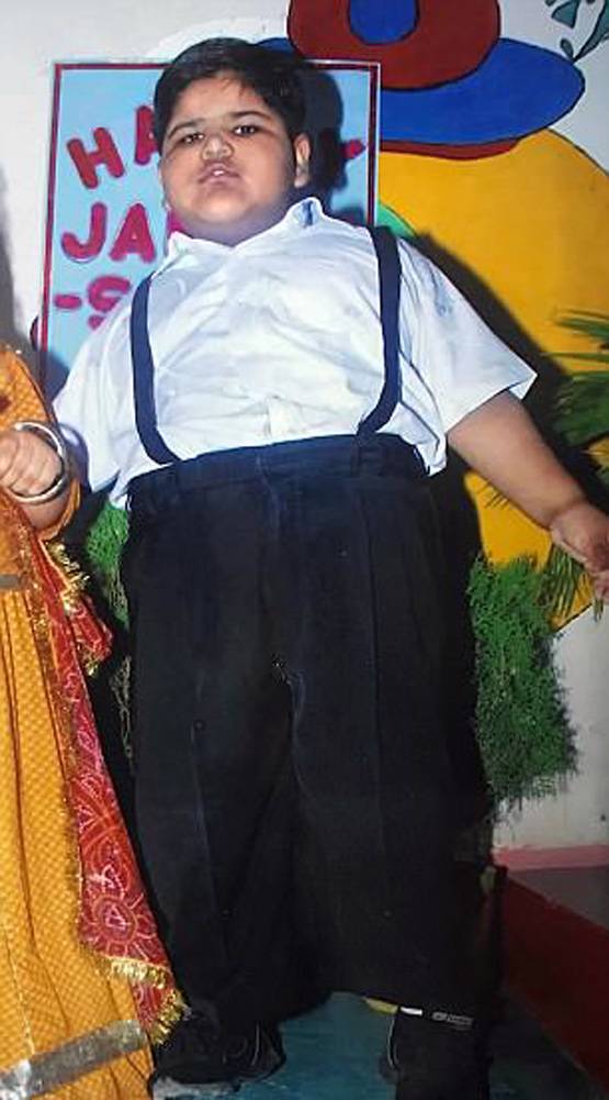 मिहिर दुनिया का सबसे मोटा बच्चा, 14 की उम्र में 237 Kg वजन!