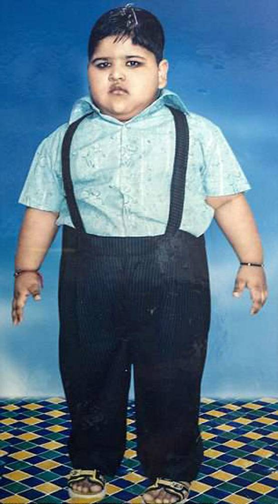 मिहिर दुनिया का सबसे मोटा बच्चा, 14 की उम्र में 237 Kg वजन!