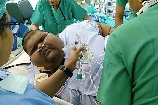 मिहिर दुनिया का सबसे मोटा बच्चा, 14 की उम्र में 237 Kg वजन!