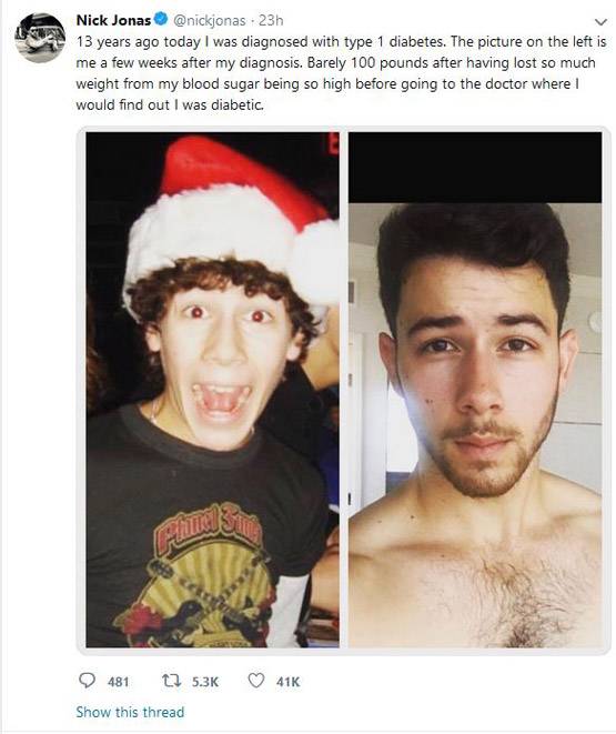 निक जोनस को है टाइप-1 डायबिटीज, आप ऐसे कर सकते हैं कंट्रोल