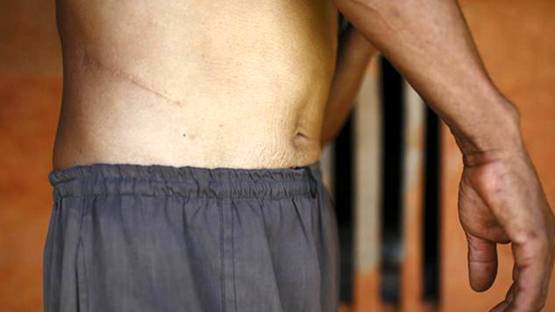 व्हाट्सएप पर डील कर बताई जगह किडनी बेचने आया शख्स, फिर...