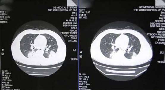 मोजा सूंघना पड़ा भारी, इस शख्स को हो गई ये खतरनाक बीमारी