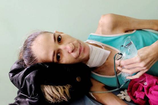 यहां फैलेगी AIDS की महामारी, HIV पॉजिटिव ले रहे घरेलू नुस्खे का सहारा