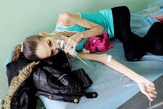 यहां फैलेगी AIDS की महामारी, HIV पॉजिटिव ले रहे घरेलू नुस्खे का सहारा