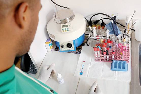 यहां फैलेगी AIDS की महामारी, HIV पॉजिटिव ले रहे घरेलू नुस्खे का सहारा