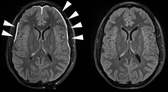 पति की मौत से सेक्स लाइफ खत्म, ठोका ₹ 8,53,26,000 का मुकदमा