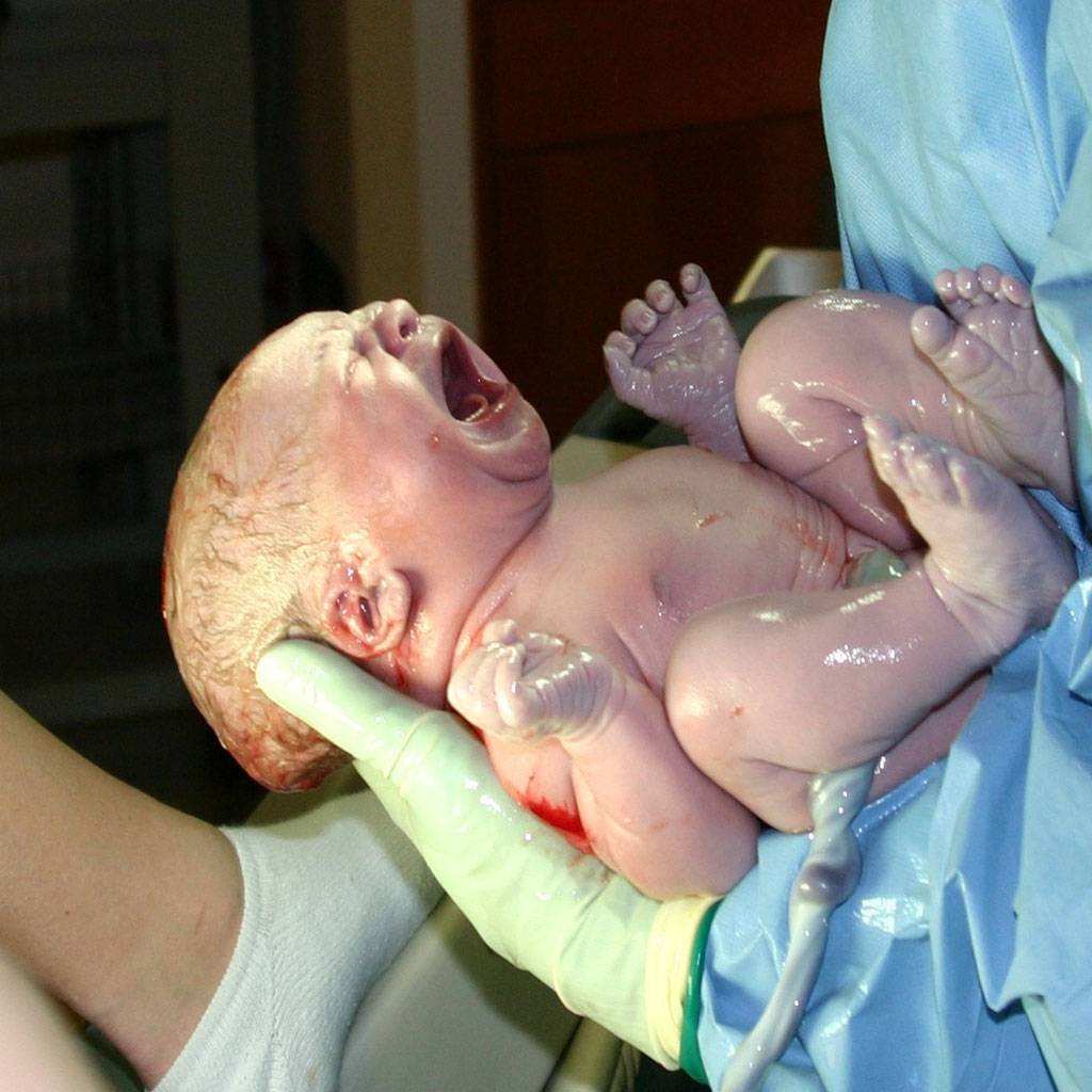 बच्चे को शहद तो नहीं चटाते आप? हो सकती है ये गंभीर बीमारी