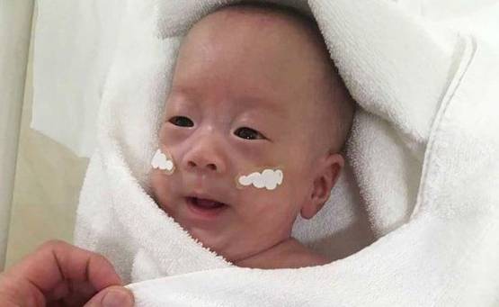 ये है दुनिया का सबसे छोटा बच्चा, एक प्याज के बराबर है साइज