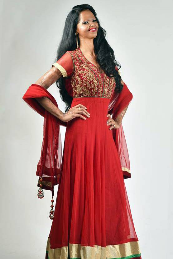 एसिड अटैक सर्वाइवर लक्ष्मी, जिसकी कहानी सुनकर रो पड़ी थीं दीपिका