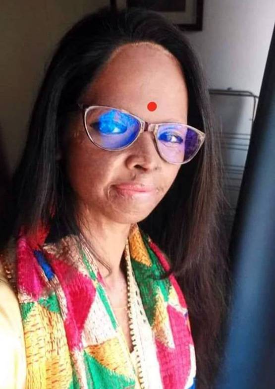 एसिड अटैक सर्वाइवर लक्ष्मी, जिसकी कहानी सुनकर रो पड़ी थीं दीपिका