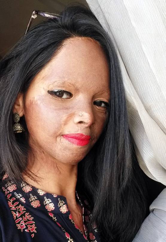 एसिड अटैक सर्वाइवर लक्ष्मी, जिसकी कहानी सुनकर रो पड़ी थीं दीपिका