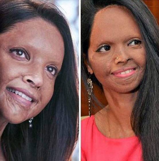 रियल लाइफ विक्टिम ने बताया एसिड अटैकर्स के लिए कैसी फिल्म है छपाक?