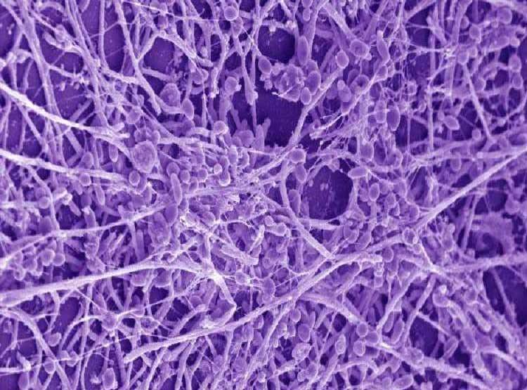 क्या है 'कैंडिडा ऑरिस' फंगस, कर देता है इम्यून सिस्टम कमजोर