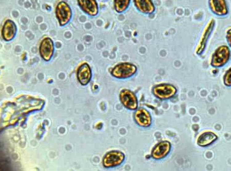 क्या है 'कैंडिडा ऑरिस' फंगस, कर देता है इम्यून सिस्टम कमजोर