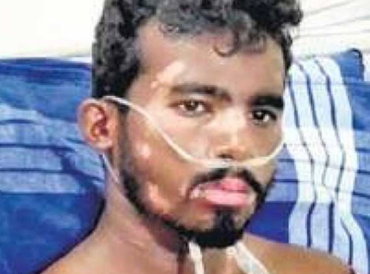 युवक की जेब में फटा एक दिन पहले खरीदा VIVO का स्मार्टफोन