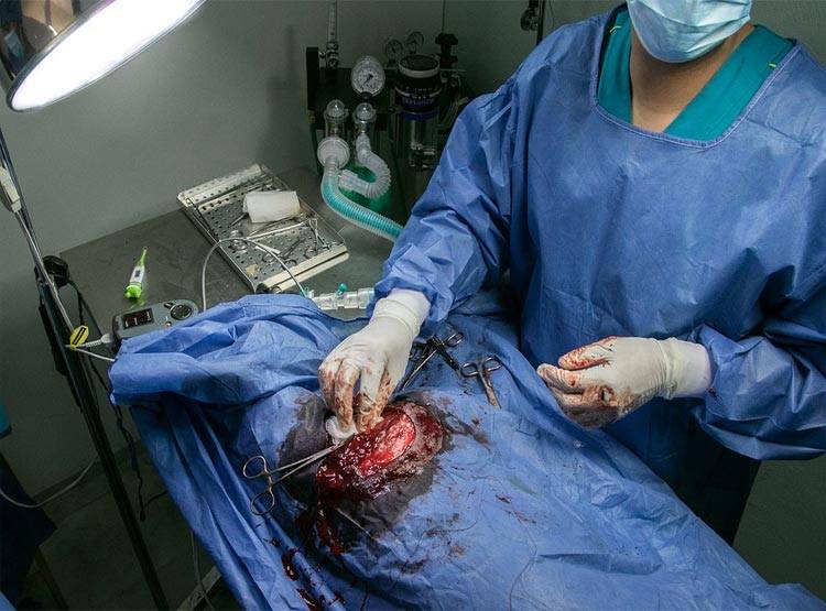महिला के X-Ray से उड़े डॉक्टरों के होश, प्राइवेट पार्ट में मिला ये सामान