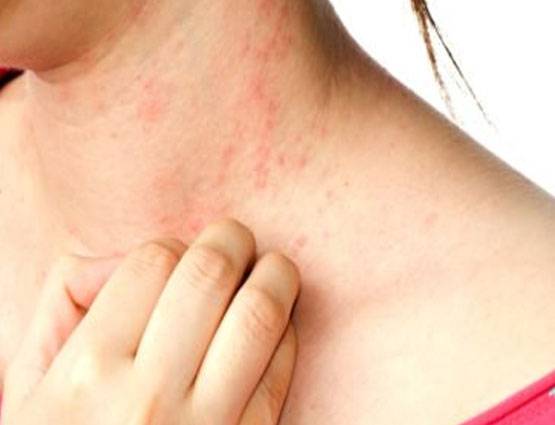 मोटापा ही नहीं दिमाग पर भी डालती है असर, एसी की ठंडी हवा!