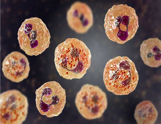 आखिर क्या है चमकी बुखार? जानें लक्षण, बचाव और सावधानियां