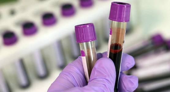 'हेपेटाइटिस बी' से हर साल हो रही लाखों लोगों की मौत, ये हैं बचाव के तरीके