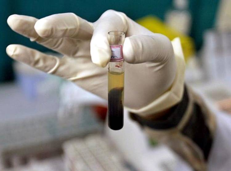 बुखार की जांच, आदमी को बताया गर्भवती, डॉक्टर क्ल‍िन‍िक बंद कर फरार