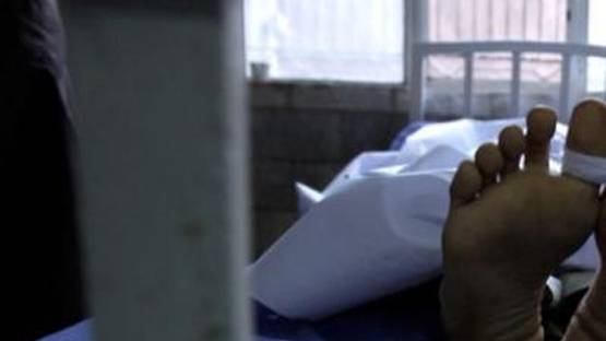 पुरुष की बॉडी पर दिखा महिला का सिर, अंग दान केंद्र की खौफनाक तस्वीर