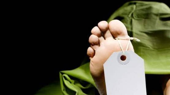 पुरुष की बॉडी पर दिखा महिला का सिर, अंग दान केंद्र की खौफनाक तस्वीर