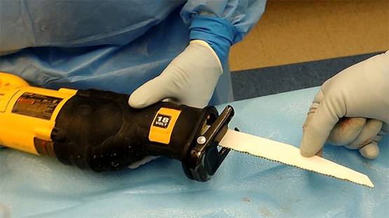 पुरुष की बॉडी पर दिखा महिला का सिर, अंग दान केंद्र की खौफनाक तस्वीर