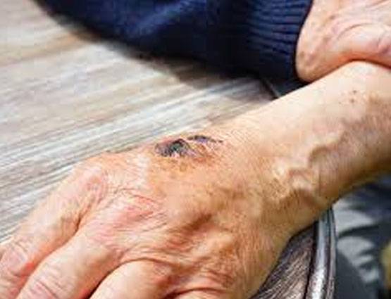 किस ग्रह की वजह से होती हैं त्वचा संबंधी समस्याएं, दूर करने के ये उपाय