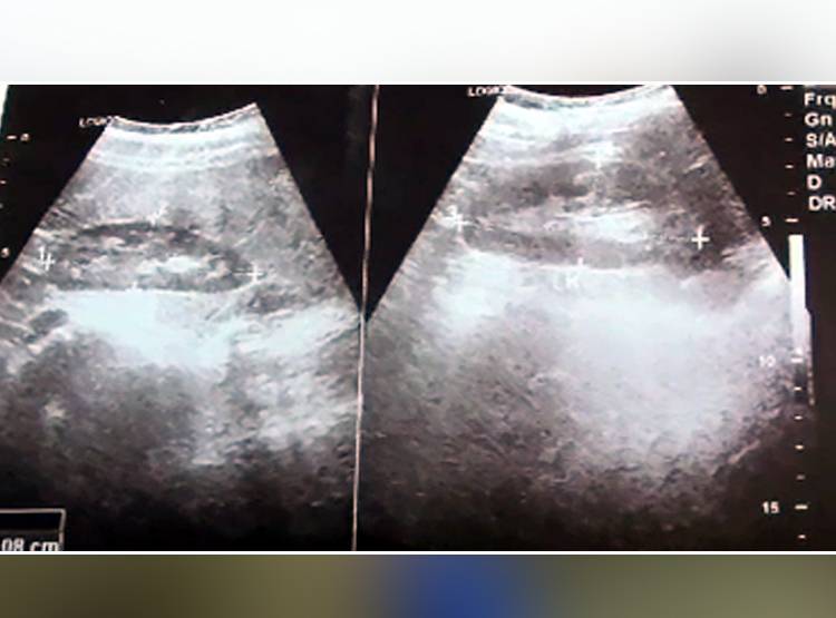 महिला और सांप के बीच अनोखा रिश्ता, देखकर लोग हैरान