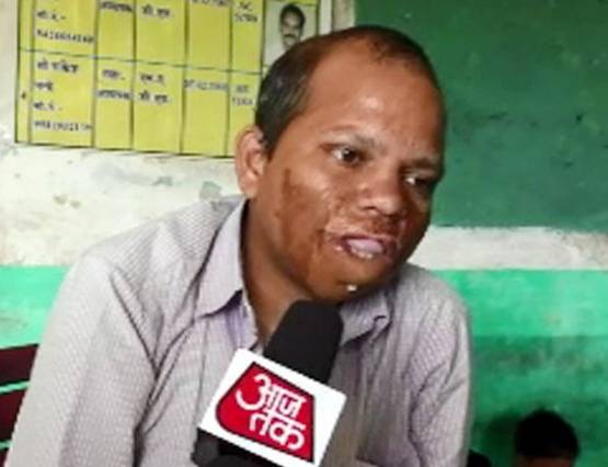 दोनों हाथ नहीं, फिर भी ब्लैकबोर्ड पर लिखकर ऐसे पढ़ाता है ये टीचर